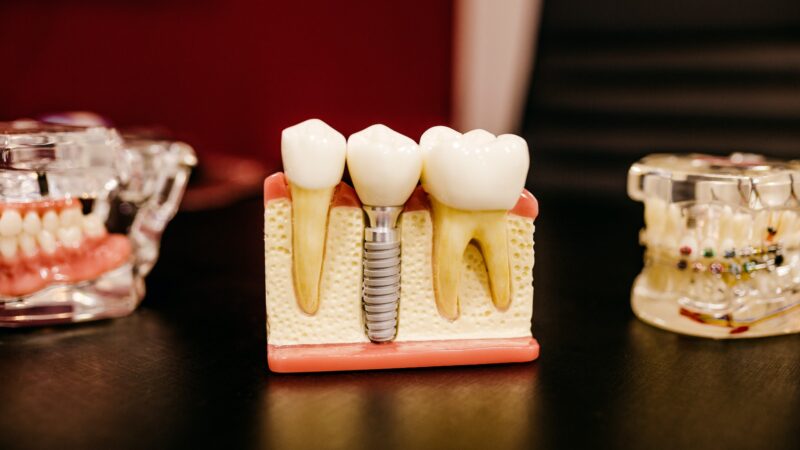 Ayuda dental para indocumentados: Opciones de Seguro Médico para Indocumentados y el Panorama Estudiantil